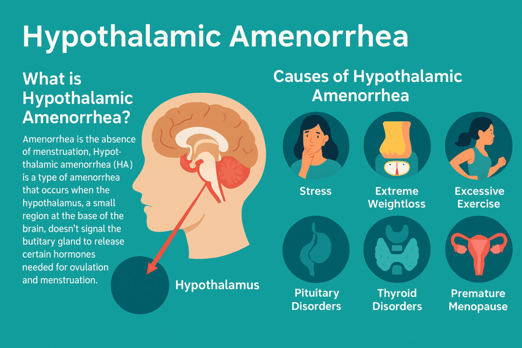  hypothalamic amenorrhea